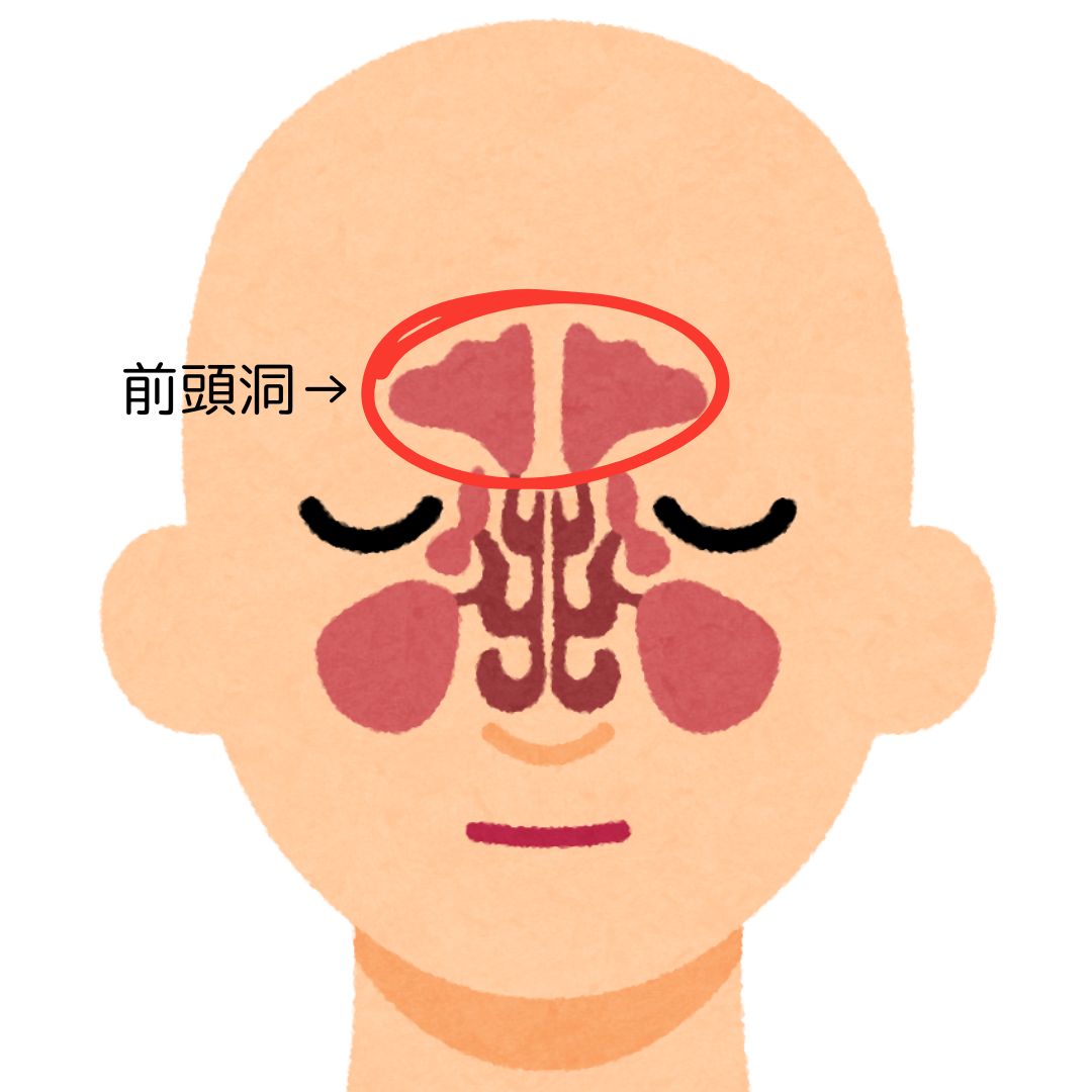 鼻前頭管 – 鼻前頭管がわからない | 鼻腔・副鼻腔とその境界、副鼻腔からの排池経路 – WGFQ